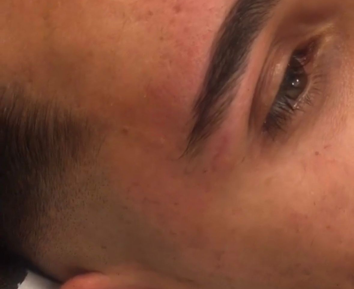 Résultat sourcil homme