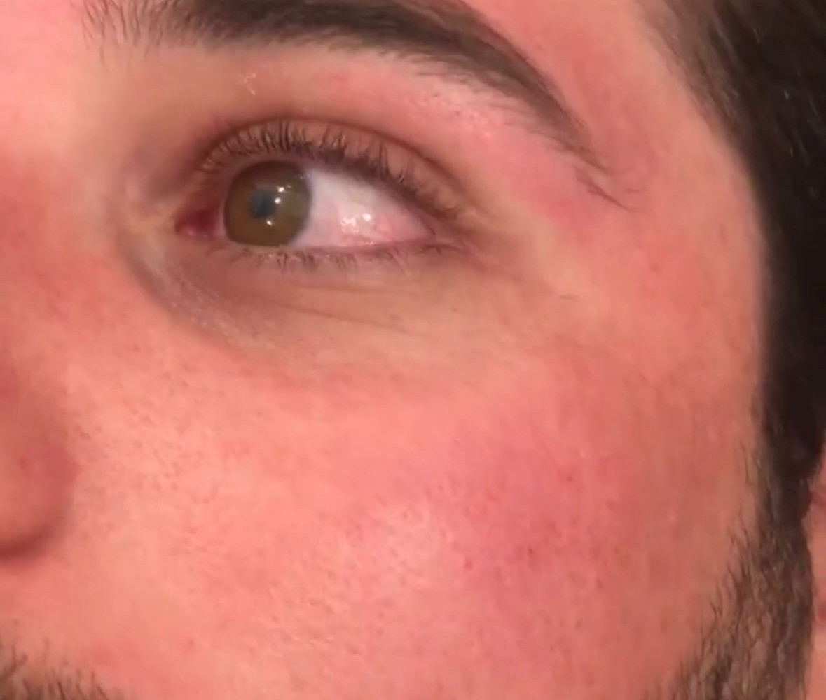 Résultat sourcil homme