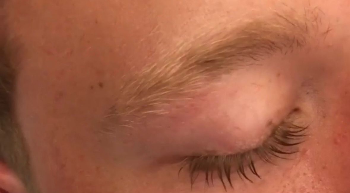Sourcil avant teinture